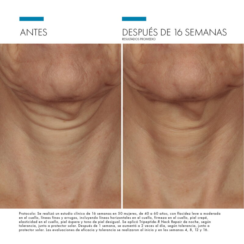 Tripeptide-R Neck Repair