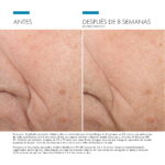 Triple Lipid Restore 2:4:2
