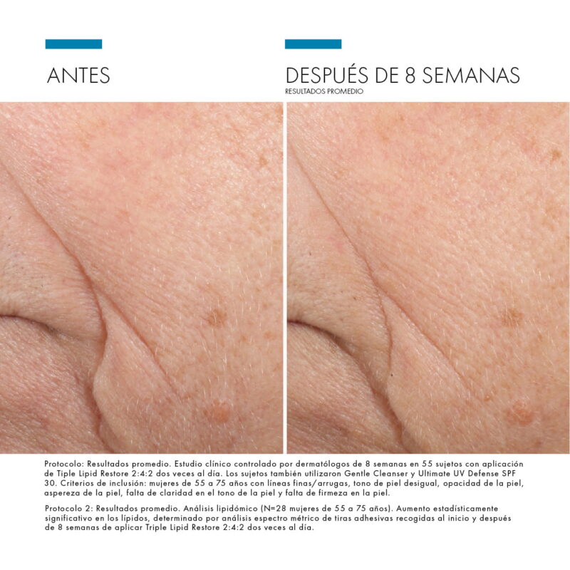 Triple Lipid Restore 2:4:2
