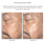 Foaming Glycolic Wash