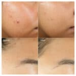 Clarifying Water Gel