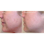 Daily Clarifying Peel