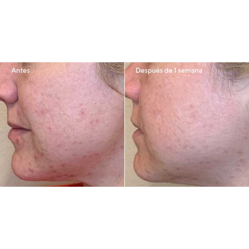 Daily Clarifying Peel