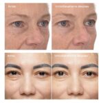 Retinol Youth Renewal Eye Masks