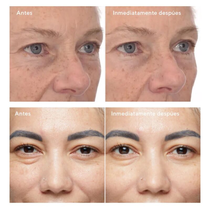 Retinol Youth Renewal Eye Masks