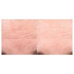 Retinol Youth Renewal Serum