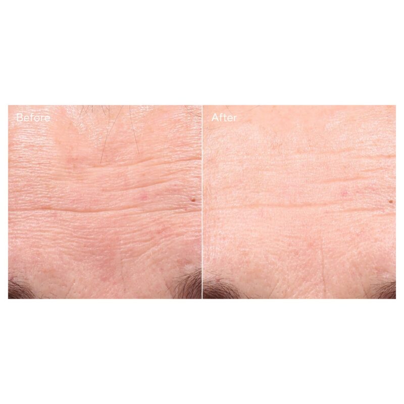 Retinol Youth Renewal Serum