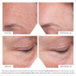 Matrix Support SPF 30