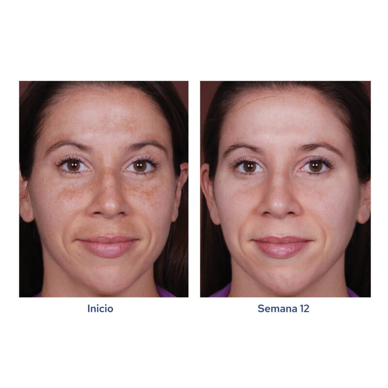 Obagi-C Fx C-Clarifying Serum