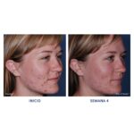 CLENZIderm M.D. Pore Therapy
