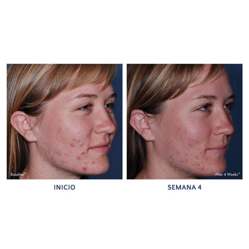 CLENZIderm M.D. Pore Therapy