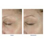 ELASTIderm Firming Eye Cream