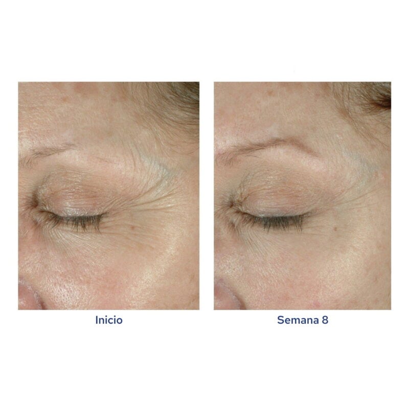 ELASTIderm Firming Eye Cream
