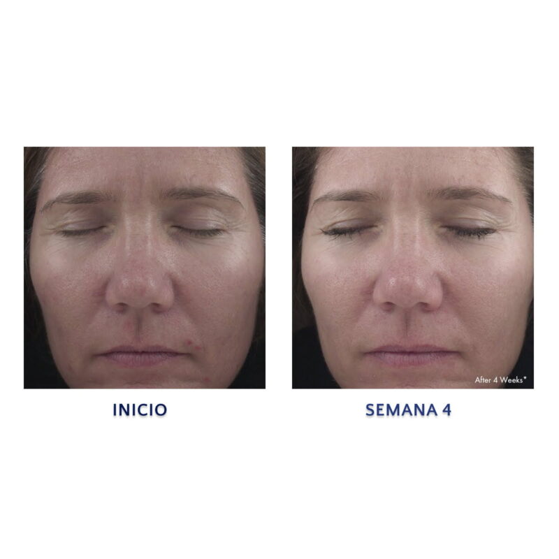 Retinol 0.5