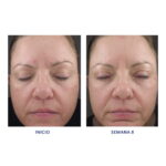 Retinol 1.0 Cream