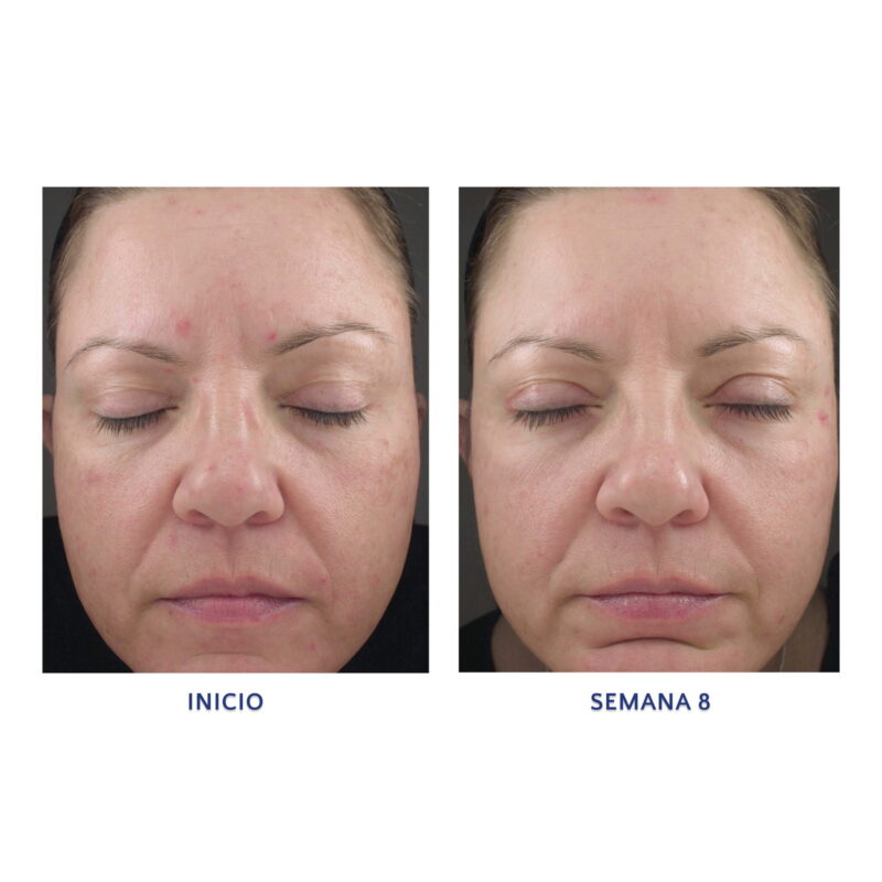Retinol 1.0 Cream