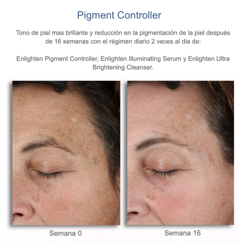 Pigment Controller