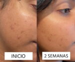 Rapid Dark Spot Correcting Serum