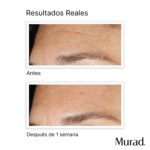 Replenishing Multi-Acid Peel