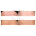 Retinol Youth Renewal Night Cream