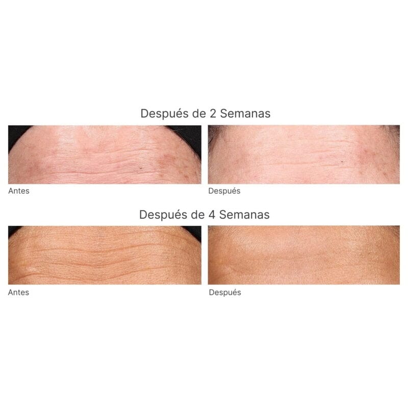 Retinol Youth Renewal Night Cream