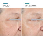 A.G.E Advanced Eye