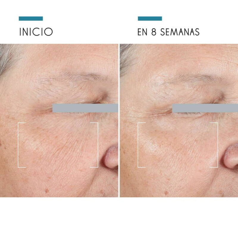 A.G.E Advanced Eye