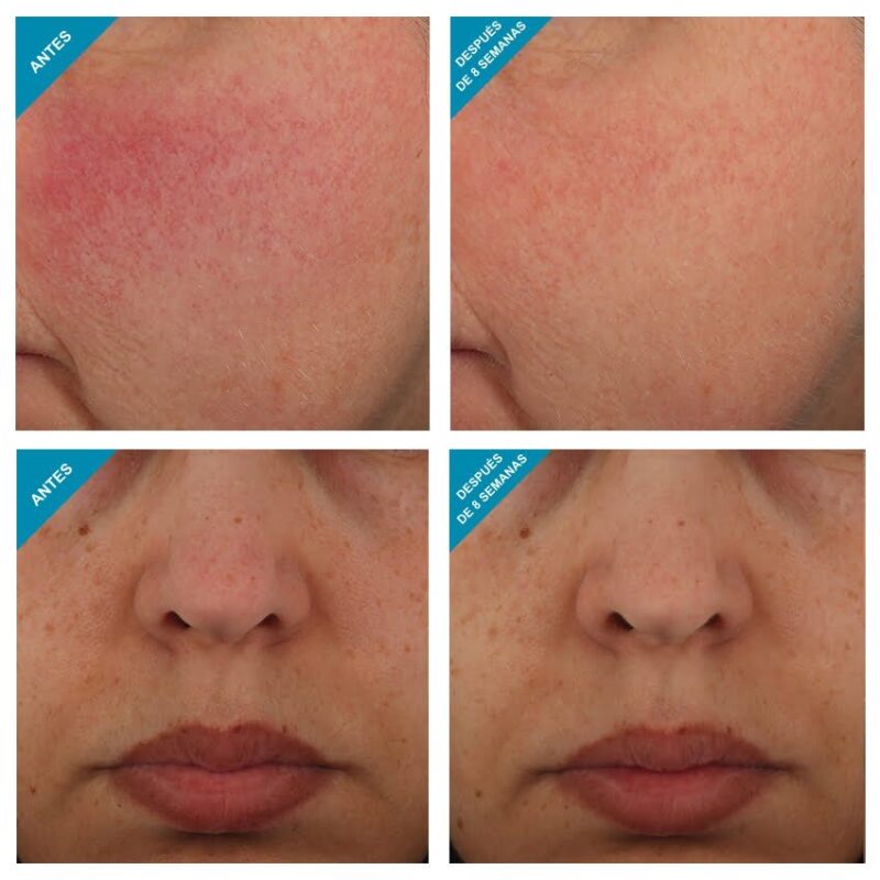 Glycolic 10 Renew Overnight