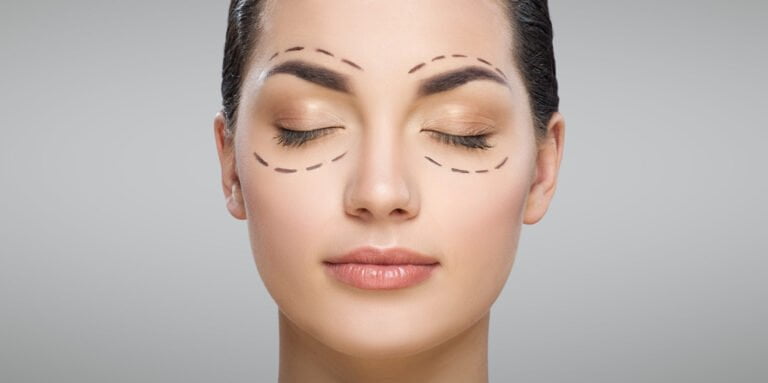 Blefaroplastia