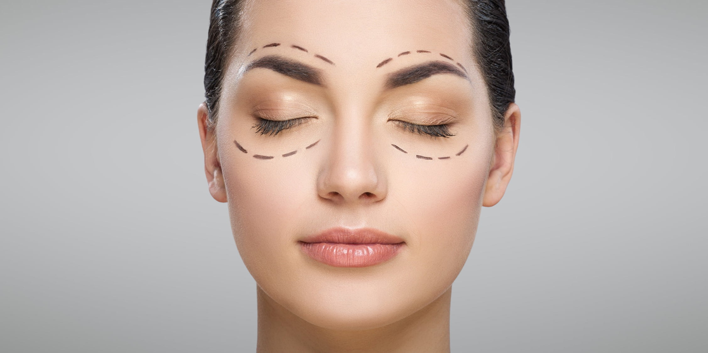 Blefaroplastia