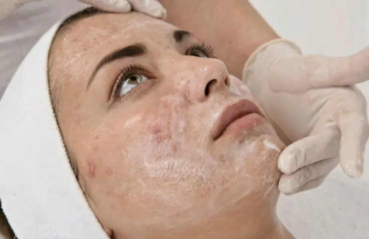Limpieza Facial Acné