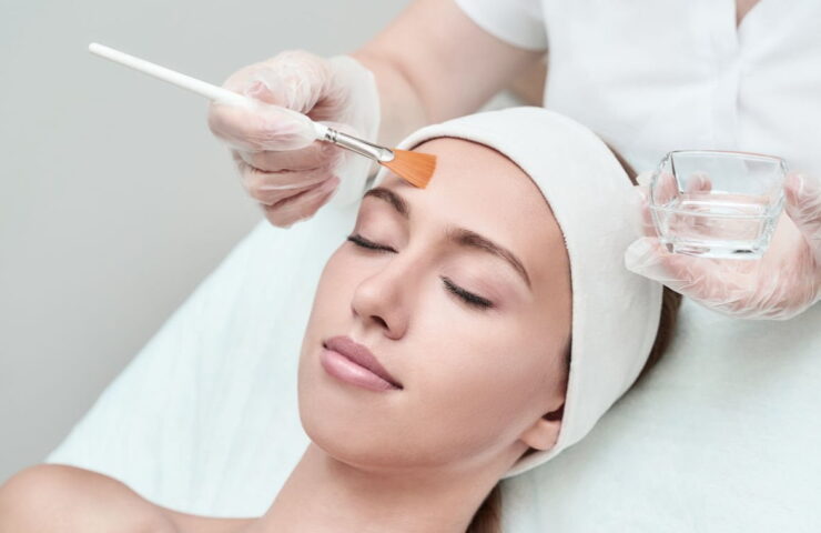Peeling Químico