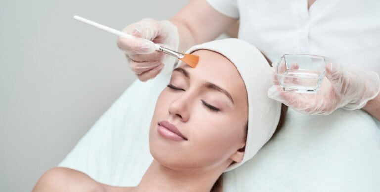 Peeling Químico