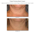 Triple Firming Neck Cream
