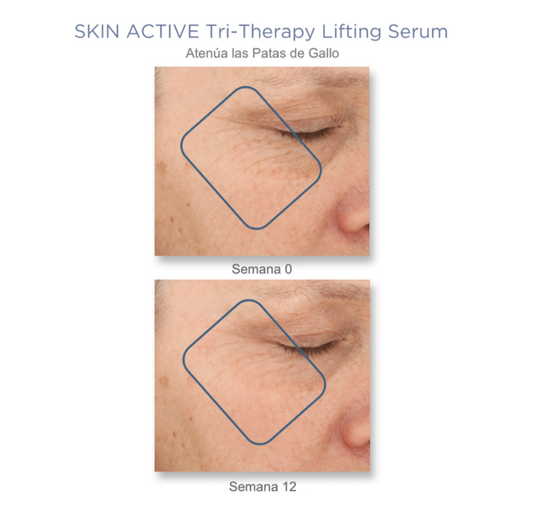 Tri-Therapy Lifting Serum