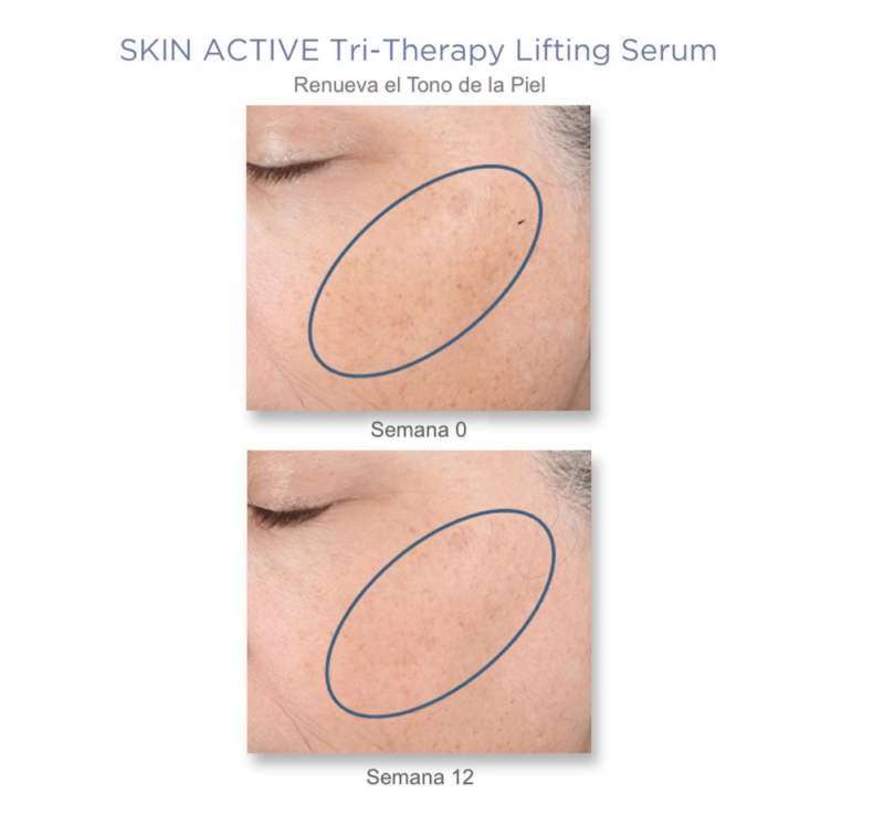 Tri-Therapy Lifting Serum