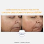 Vitamin C 15% + PHA Serum