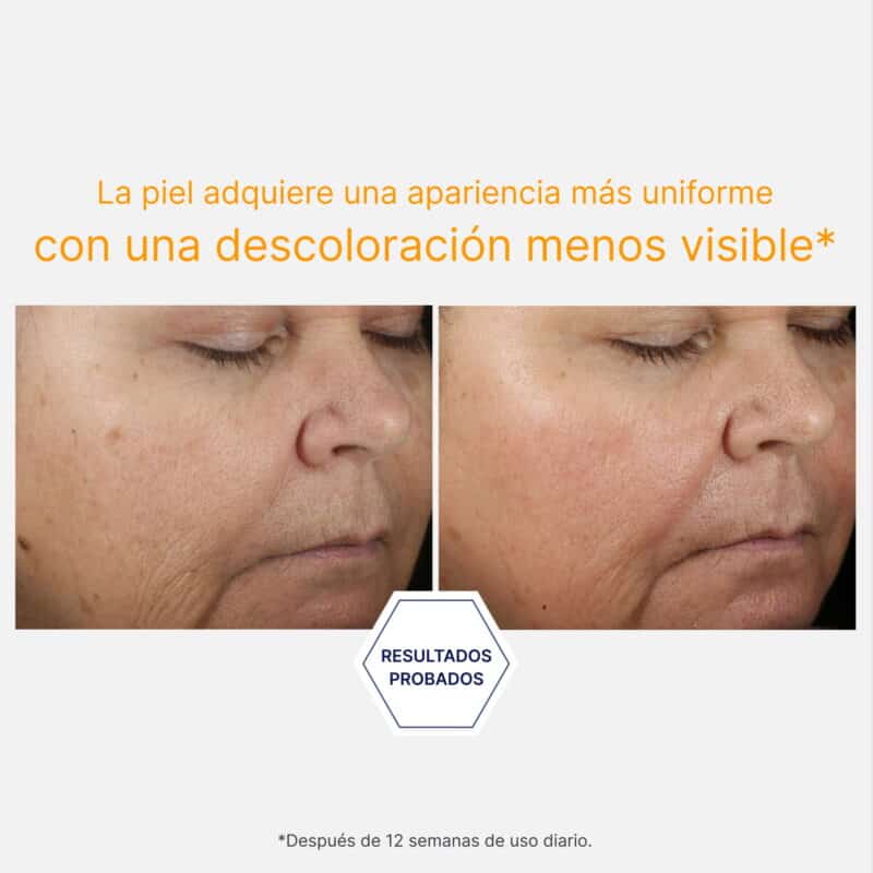 Vitamin C 15% + PHA Serum