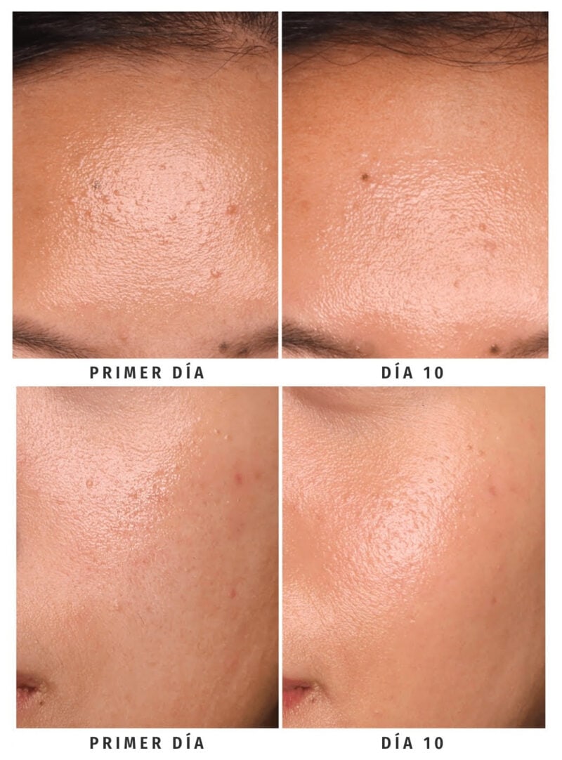 Mandelic Acid Gentle Exfoliating Toner