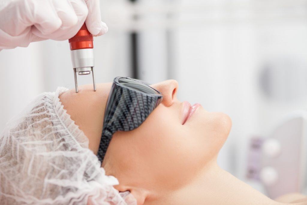 ¿En qué consiste el Micro Láser Peel y para qué se Utiliza?