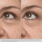 Daily Hydro-Drops Eye Gel Cream