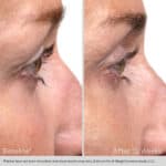 Nu-Cil Eyelash Enhancing Serum