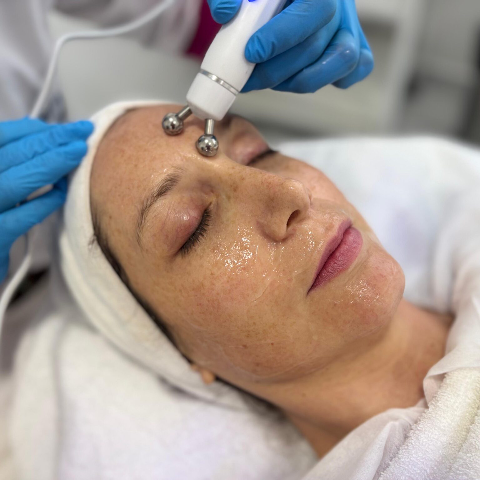 Hydra Facial Glow