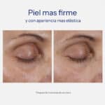 Intensive Eye Therapy