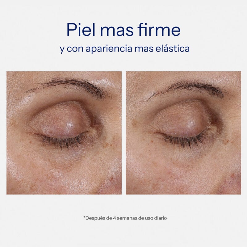 Intensive Eye Therapy