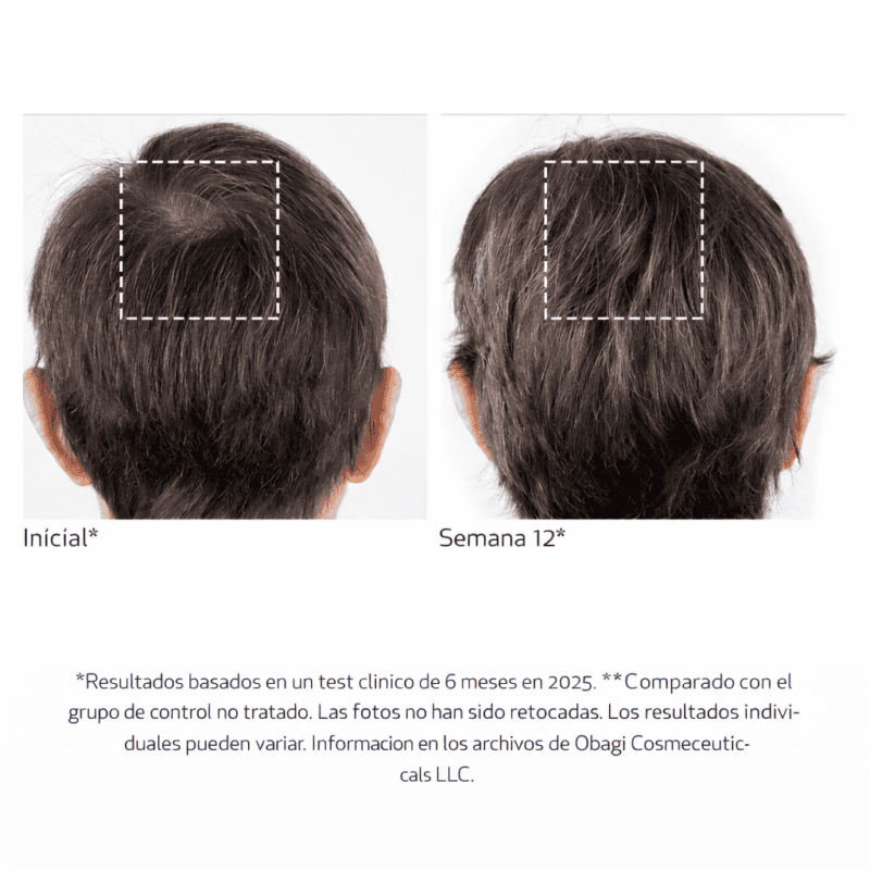 Nu-Cil BioStim Scalp Serum