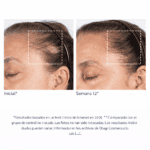 Nu-Cil BioStim Scalp Serum