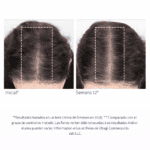 Nu-Cil BioStim Scalp Serum