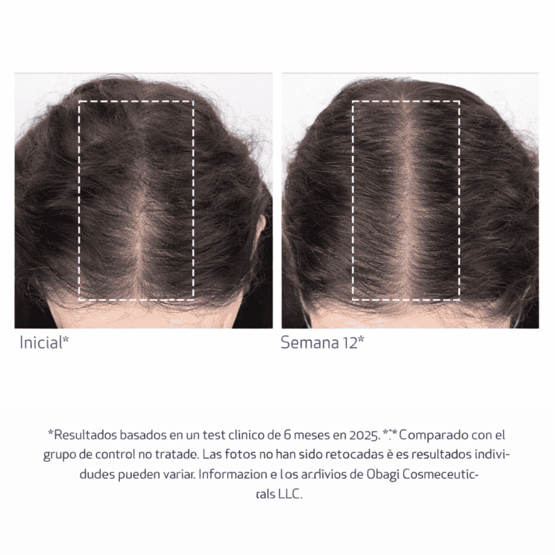 Nu-Cil BioStim Scalp Serum