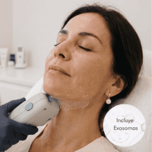 HIFU Facial + Exosomas | Lifting y Regeneración Celular